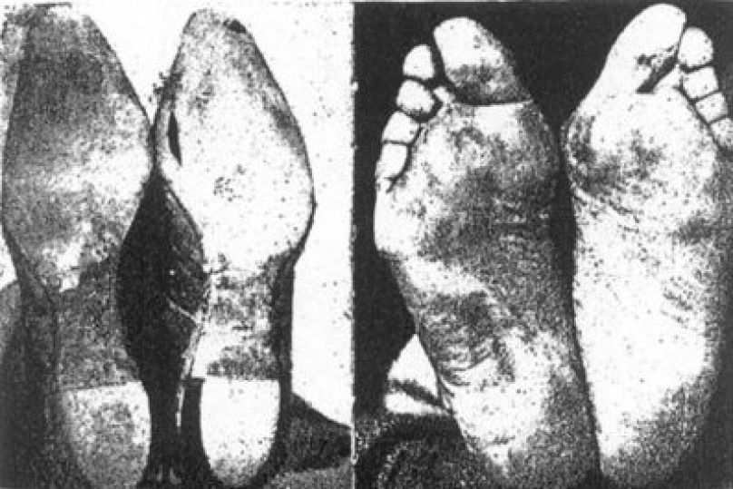 shoe shaped feet